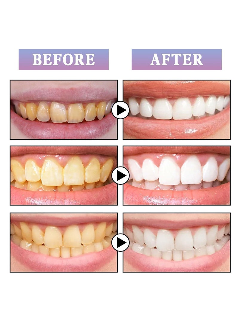 KASTWAVE KASTWAVE Tooth Gloss, 2 Pcs Purple Teeth Whitening, Tooth Stain Removal, for Tooth Stain Removal, Instant Gloss Results, Fast Removes Years of Stains  - Image 5