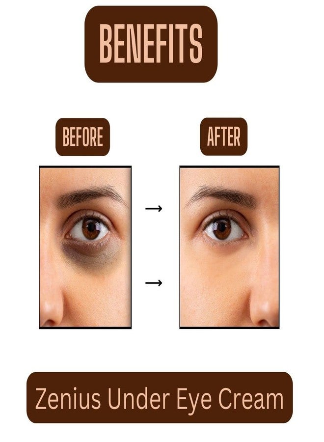 Zenius India Under Eye Cream to Reduce Dark Circles and Puffy Eyes and Brighten, for All Skin Types, Unisex, 50gm - Image 5
