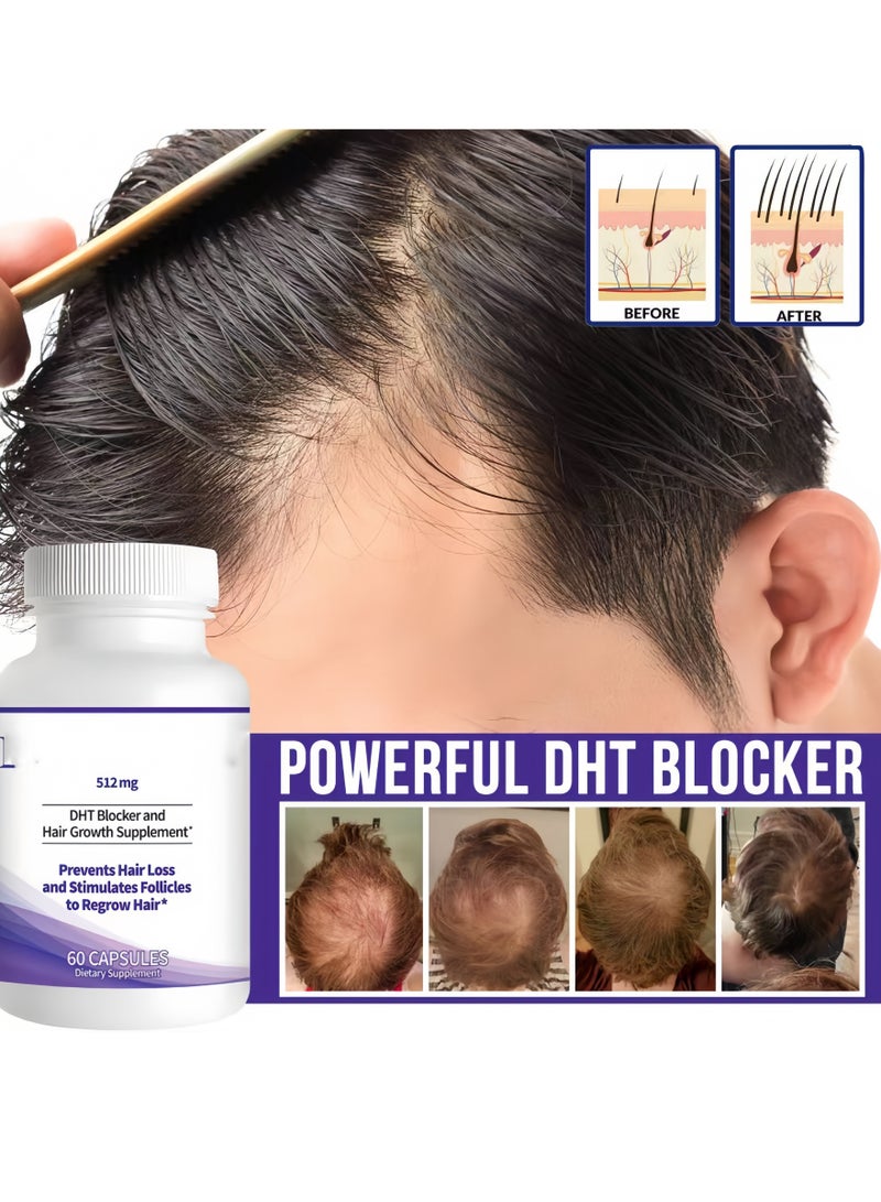 برونيكسا يمنع ملحق النمو المانع لـ DHT أن تساقط الشعر ويحفز الجاذبية النموز على الشعر 60 كبسولة - Image 4