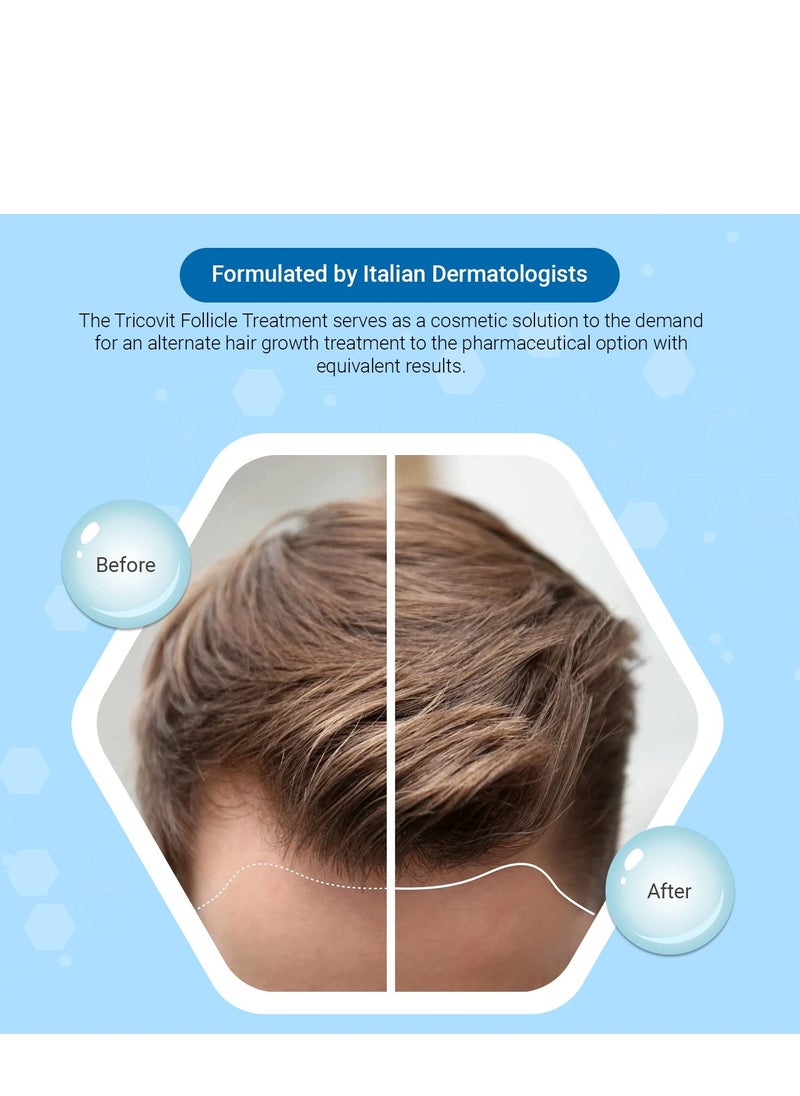 TricoVit - Tricovit Shampoo - Routine Hair Growth Shampoo For Thinning Hair - Promotes Stronger and Thicker Hair With Natural Active Ingredients - 8.4 oz - Image 1