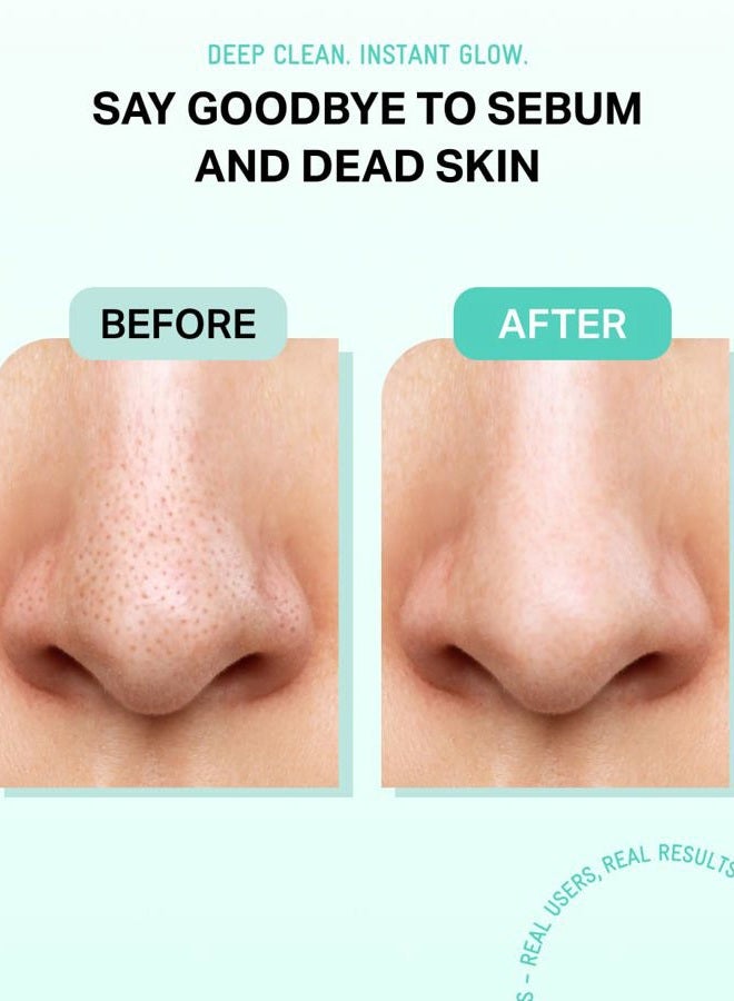 BRING GREEN Tea Tree Cica Sebum Cleaning Gel Set | Korean Blackhead Remover & Pore Minimizer with Pore Cleaner Tool | Sebum Softener for Face, Nose & Chin | Gentle Alternative to Pore Strips & Vacuums - Image 3