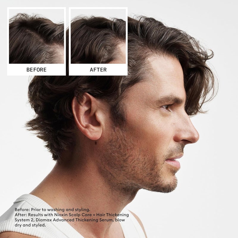 Nioxin System 2 Scalp Therapy Conditioner for Natural Hair with Progressed Thinning 338 Oz - Image 1