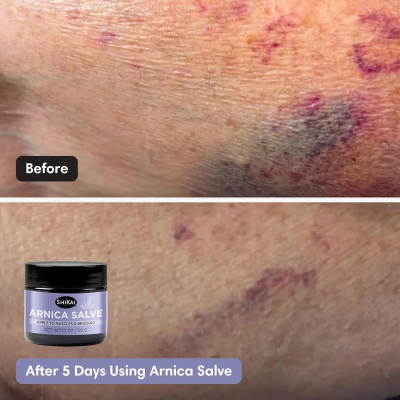 ShiKai Arnica Salve 17 oz Soothing Arnica Cream for Muscle Bruising Moisturizing Body Barrier Lotion with Eucalyptus Shea Butter Beeswax - Image 4