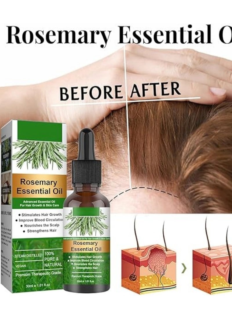 EELHOE Generic EELHOE Rosemary Hair Growth Essential Oil Prevent Hair Loss Nourish Scalp Strengthen Hair 30ml - Image 2