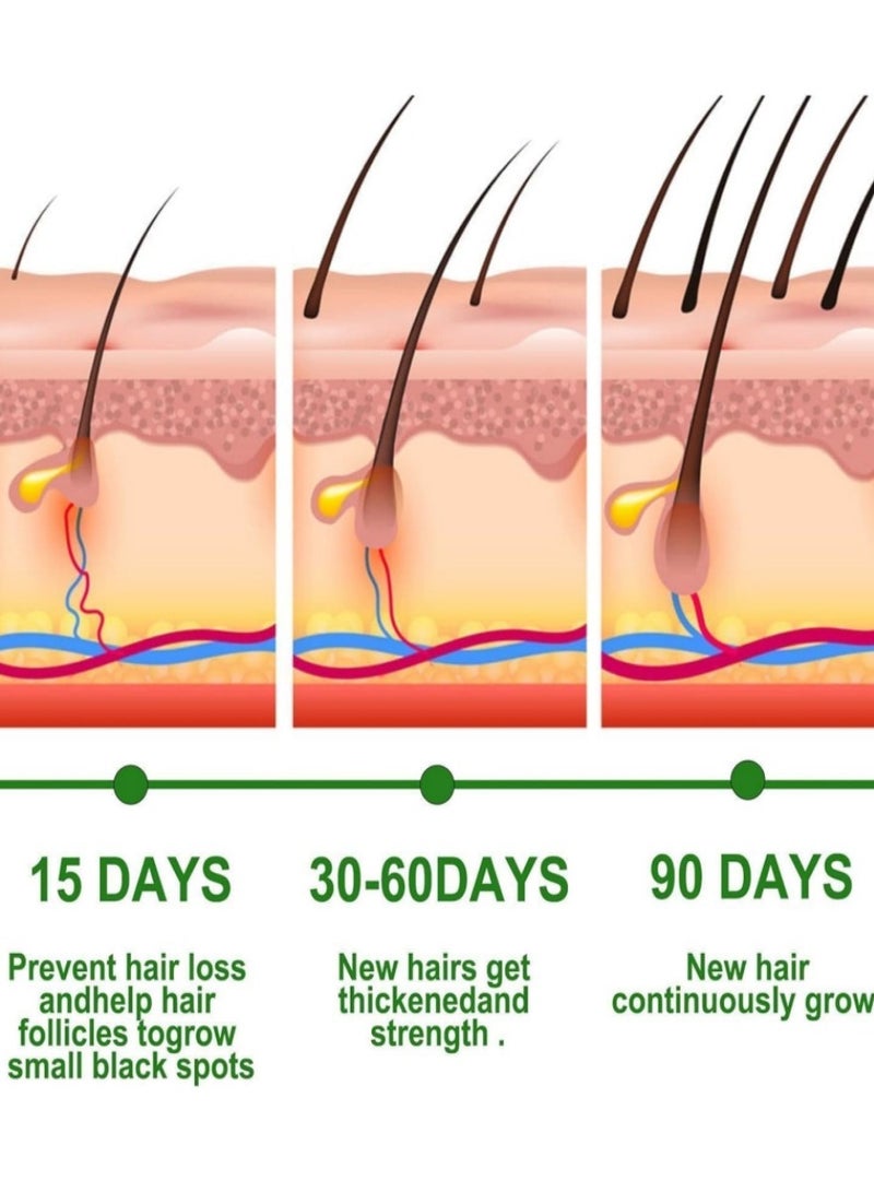 EELHOE Generic EELHOE Rosemary Hair Growth Essential Oil Prevent Hair Loss Nourish Scalp Strengthen Hair 30ml - Image 4