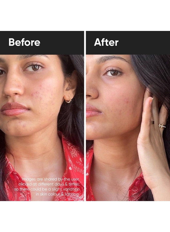 Herbal Max Herbalmax Discover Wellness Nutraceutical L Glutathione Tablets for Skin Whitening With Vitamin C - 30 Tablets |L Glutathione & Vitamin C | Sugar-free Antioxidant for Randiant Skin | - Image 2