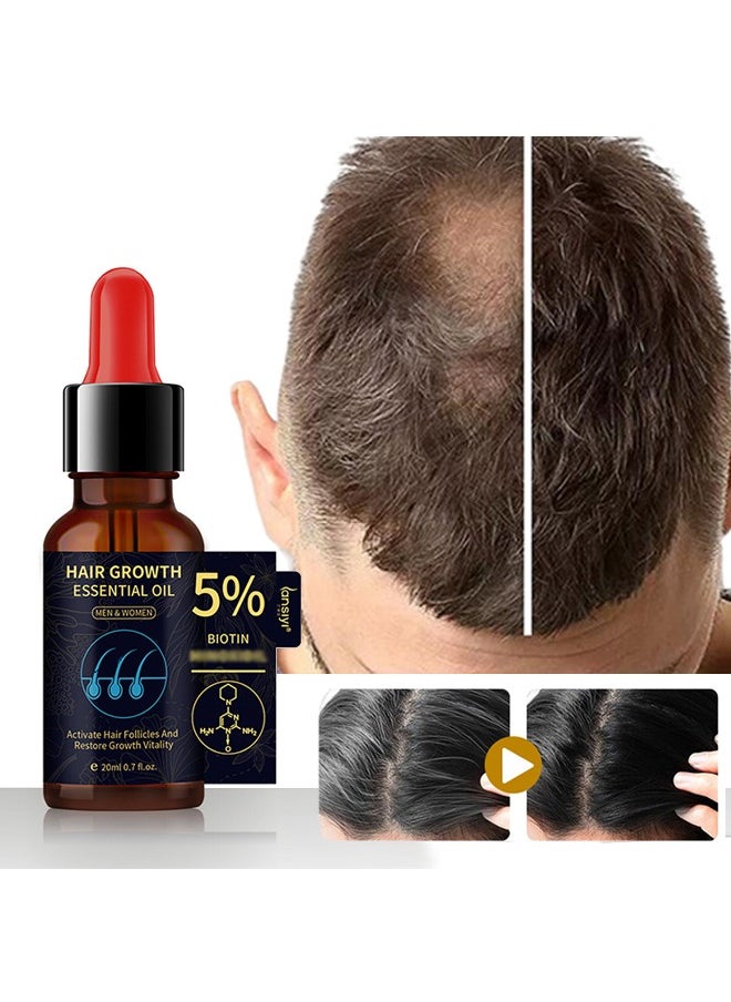 lansiyi Hair Growth Essential Oil ，5% Minoxidil and Biotin with Natural Herbal Extract for Women Men Hair Regrowth Hair Loss Hair Thinning Treatment 20ml  - Image 1