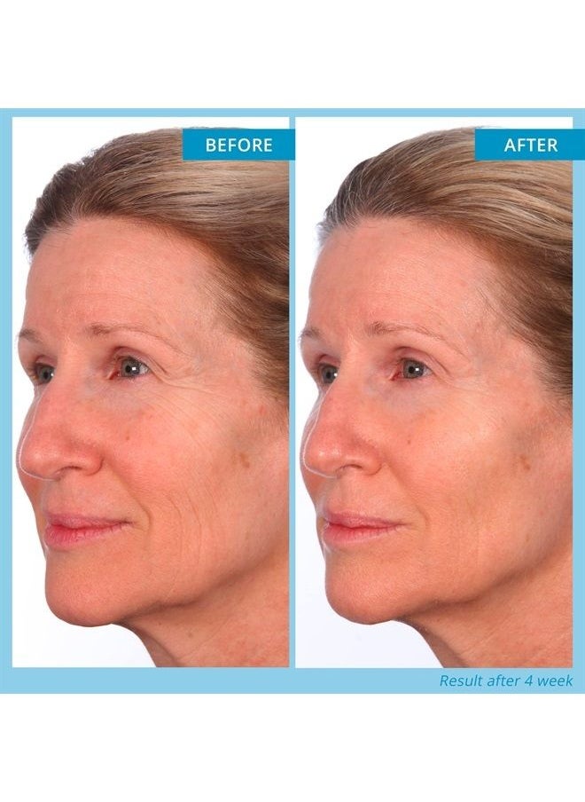 Skinn - Deep Wrinkle Facial Serum, Intensive Age Reset Serum - Anti Wrinkle Repair Face Serum - Hydrating & Plumping Anti Aging Serum Reduces Fine Lines - Ferulic Acid, Retinol, Vitamin C & NAD - Image 1