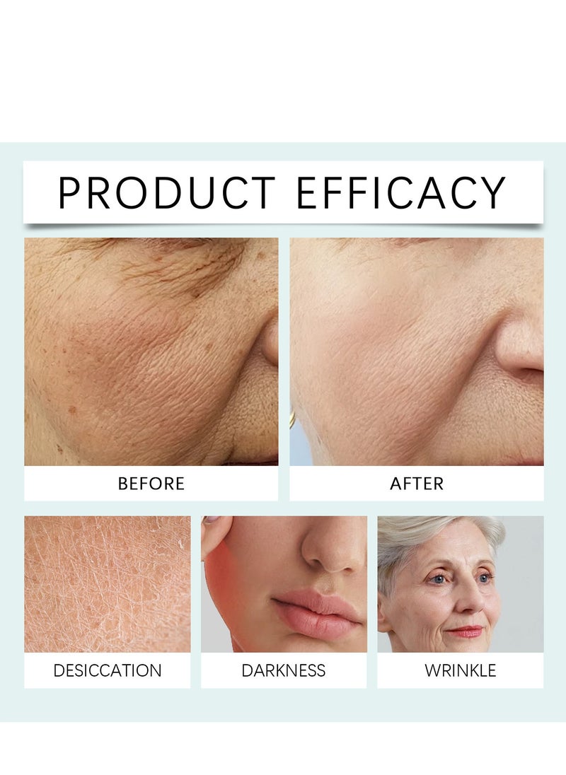 Hoygi - Renewal Face Cream, Renewal Face Cream Anti-Wrinkle Skin Repair Face Cream, Brightening Facial Cream, Dark Spots Cream,Face Wrinkle Cream for All Skin Types, Saam Face Cream Korean 50g - Image 1