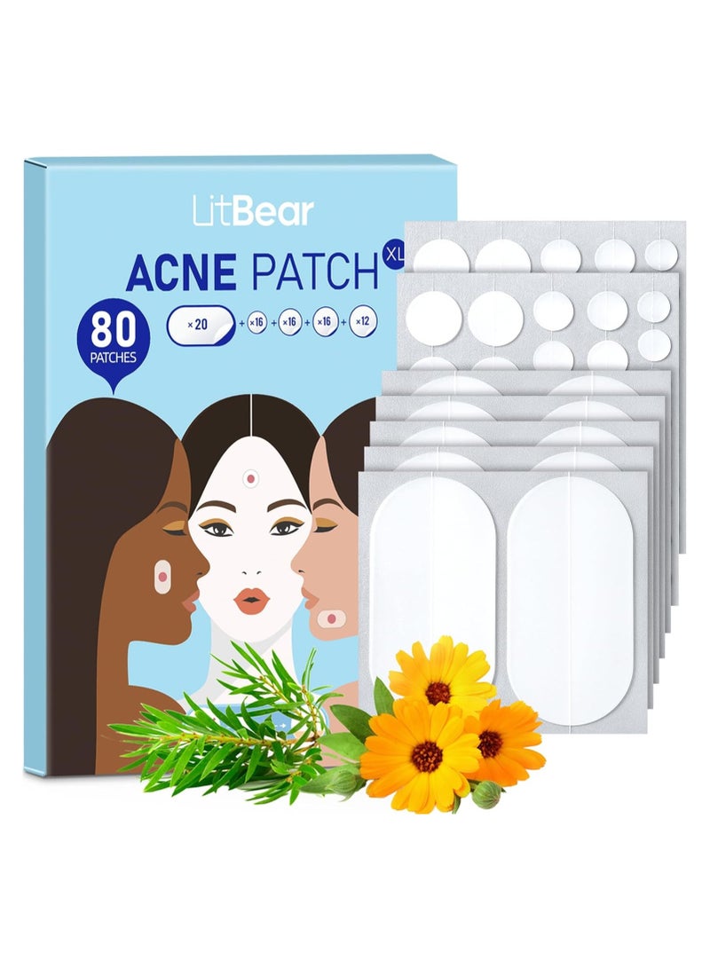LitBear Large Acne Pimple Patches, 5 Sizes 80 Patches for Large Breakouts, Acne Patches for Face, Chin or Body, Acne Spot Treatment with Tea Tree & Calendula Oil, Hydrocolloid Bandages for Acne Skin