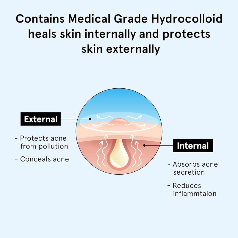 Bodywise لصقات حب الشباب للنساء من بي بودي وايز 48 نقطة 3 أحجام عبوة من 2 - Image 4