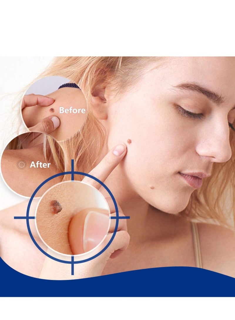 سوميفون مزيل الثآليل ، سائل الثآليل بحمض الساليسيليك بأقصى قوة ، شرائط مزيل الثآليل غير المرئية بخطوة واحدة ، سائل الثآليل سريع المفعول للتجميد للثآليل ، الثؤلول الأخمصي ، الثؤلول الشائع ، الثؤلول المسطح 20 مل - Image 4