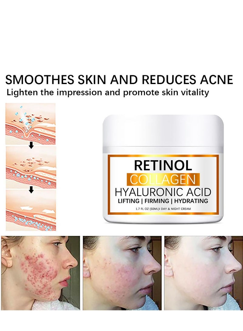 Retinol Cream for Face, Anti-Aging Moisturizer with Hyaluronic Acid & Vitamin E, Collagen Cream for Wrinkles & Dark Spots, Night Cream for Youthful Skin (1.7 Oz) - Image 5