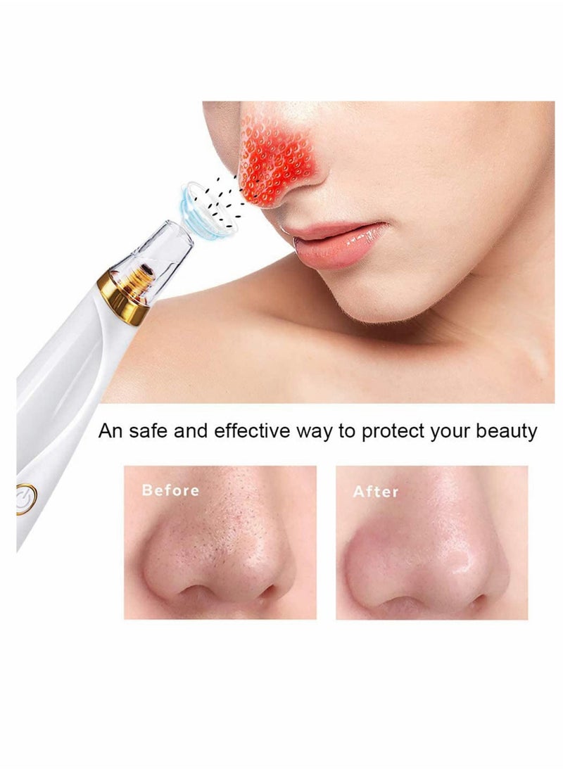 Y&D - Blackhead Remover, 3 Modes Electric Small Bubble Pore Cleanser, Facial Massage with Curved Needle Kit, Portable Easy to clean, Smooth Skin, Absorb Grease, Female Beauty - Image 1
