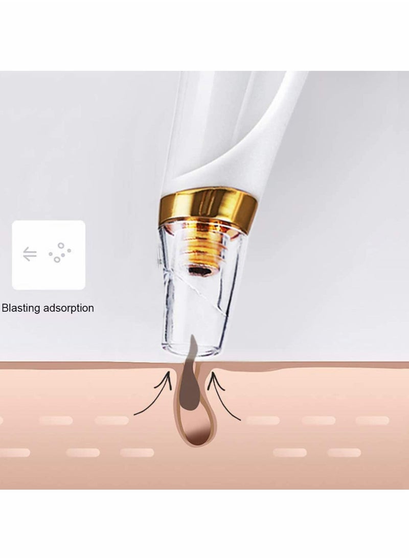 Y&D - Blackhead Remover, 3 Modes Electric Small Bubble Pore Cleanser, Facial Massage with Curved Needle Kit, Portable Easy to clean, Smooth Skin, Absorb Grease, Female Beauty - Image 1