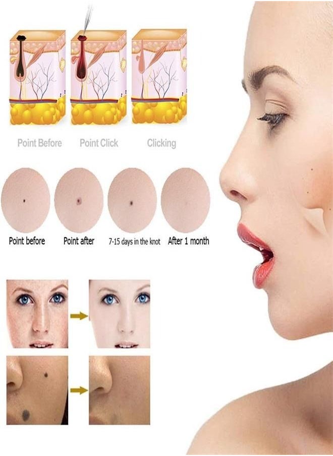 Generic Home Use Pico Laser Pen Laser Plasma Needles Remover Set for Mole Wart Dark Spot Freckle Skin Tag Removal Painless Beauty Device for Spot and Tattoo Skin Care Tool Replacement Accessories (Gold)  - Image 3