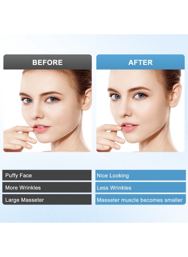 Micro-Current Red & Blue Light Face Slimmer - Vibration Lifting V-Line Skin Rejuvenation Beauty Device - Image 2