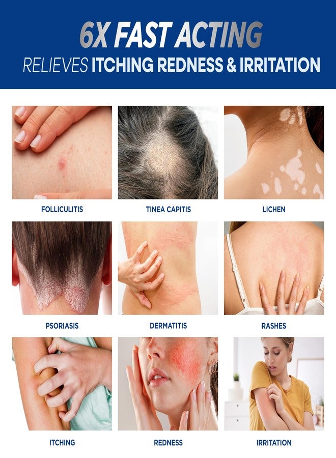 Hermon Folliculitis Cream: Effective for Folliculitis Scalp Face and Body 100g - Image 4