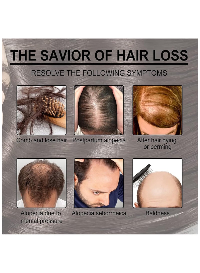 EELHOE Rosemary Hair Care Essential Oil 30ml - Image 3