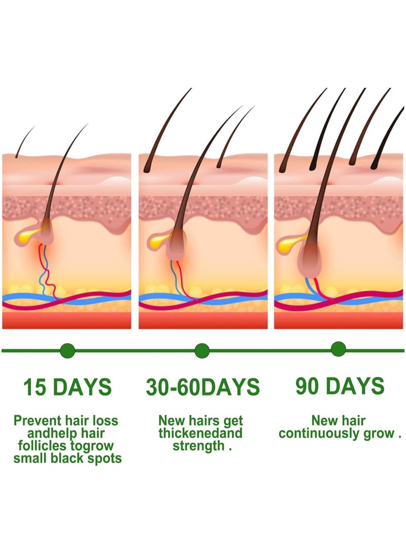 EELHOE Rosemary Hair Care Essential Oil 30ml - Image 5