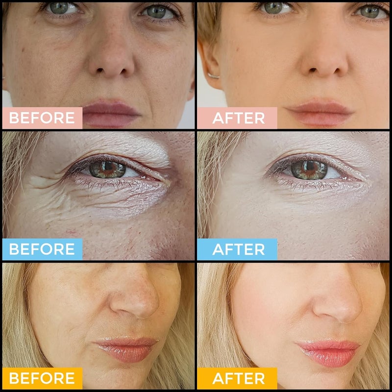 +1HEROLABS Facial Skin Care Set Retinol Serum Vitamin C Hyaluronic Acid for Face Anti Aging Face Serum Set for Women Firm Wrinkle Smoothing Dark Spot Corrector Brighten Dullness - Image 4