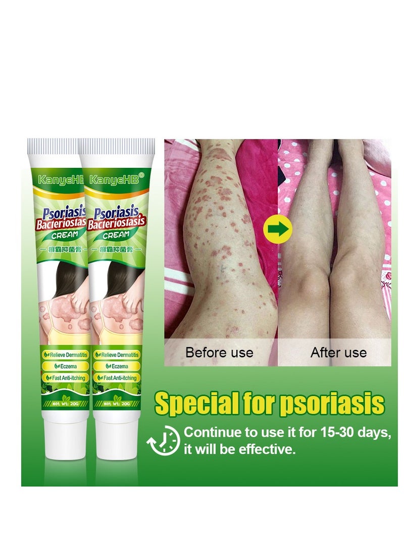 KanyeHB - Soothing Antibacterial Cream – Herbal Formula for Skin Health - Image 1