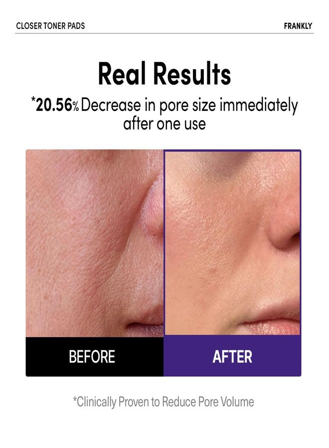 FRANKLY Pore Closer Toner Pads l Rice Jelly Pads with 9 Peptides, Vegan Collagen, Rice Extract l Pore Minimizer l Hydrating for All Skin Types l Korean Skin Care - Image 2