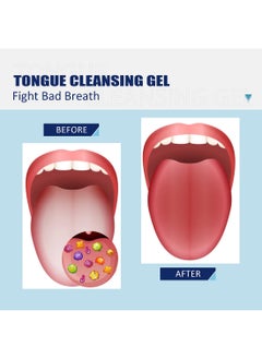 EELHOE Tongue Cleaning Gel Set, Tongue Cleaner Gel with Soft Tongue Brush, Easy to Use Tongue Scraper Precise Cleaning Brush Kit, Keep Fresh Breath 50g  - Image 2