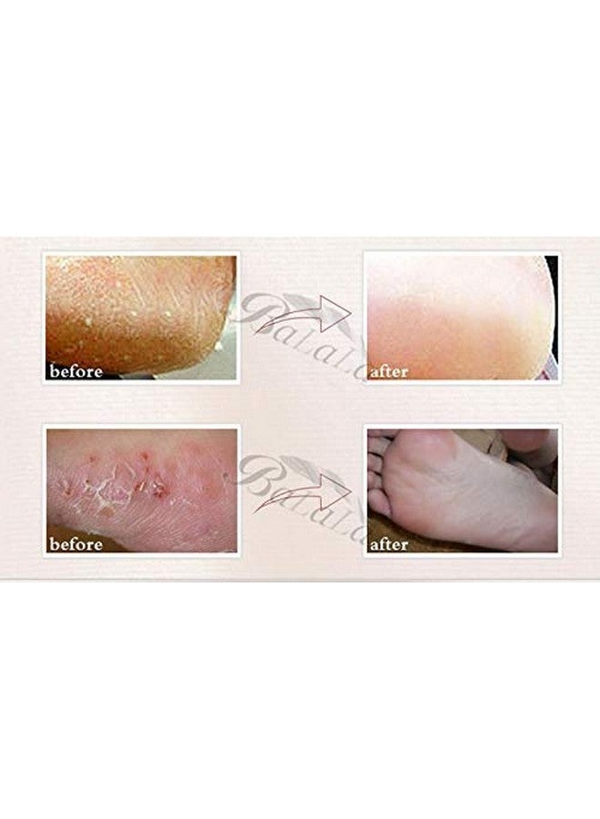 siddhmurti Moisturize Skin Repair Cracked Moisturizing Treatment Gel Spa Socks - Image 4