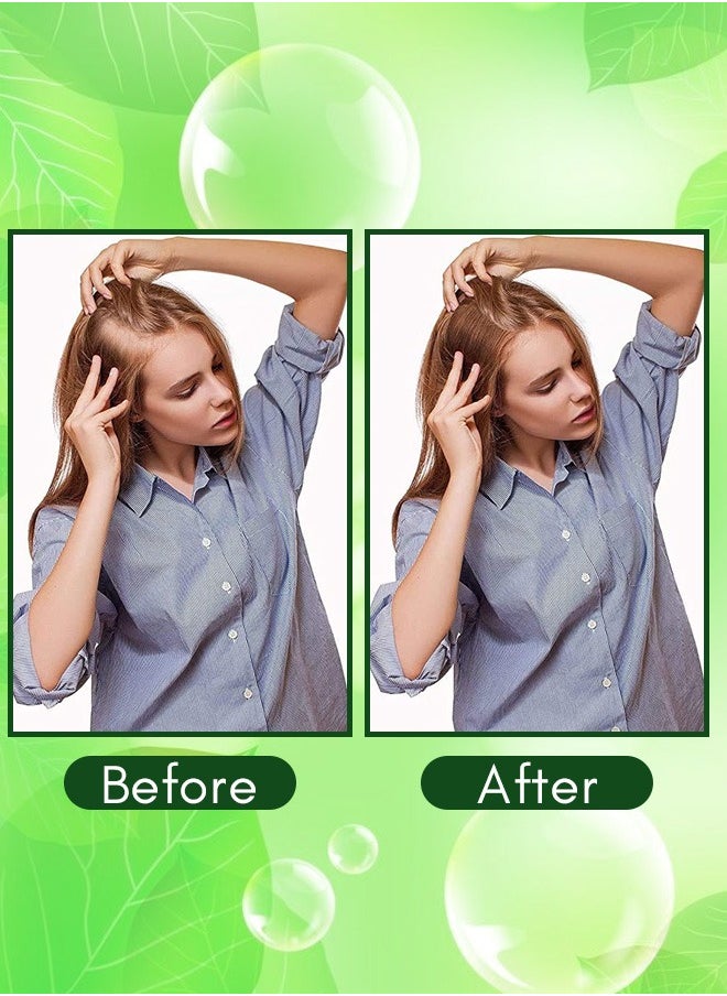 ALIVER - 2 Pcs Rosemary Essential Oil for Hair Growth Pure Organic Rosemary Oil for Dry Damaged Hair and Growth Hair Scalp Oil Hair Loss Treatment Oil for Men and Women 60ml x 2 - Image 1