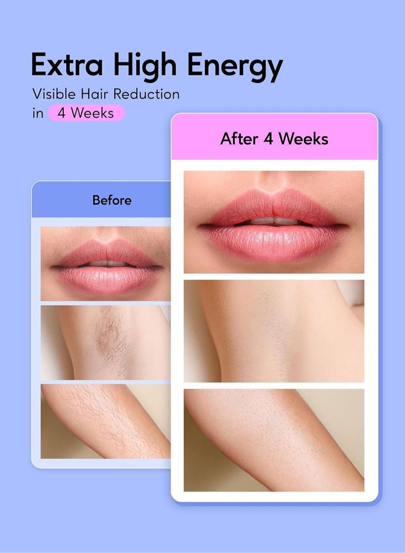 سيتا جهاز إزالة الشعر بتقنية IPL للنساء والرجال - Image 4