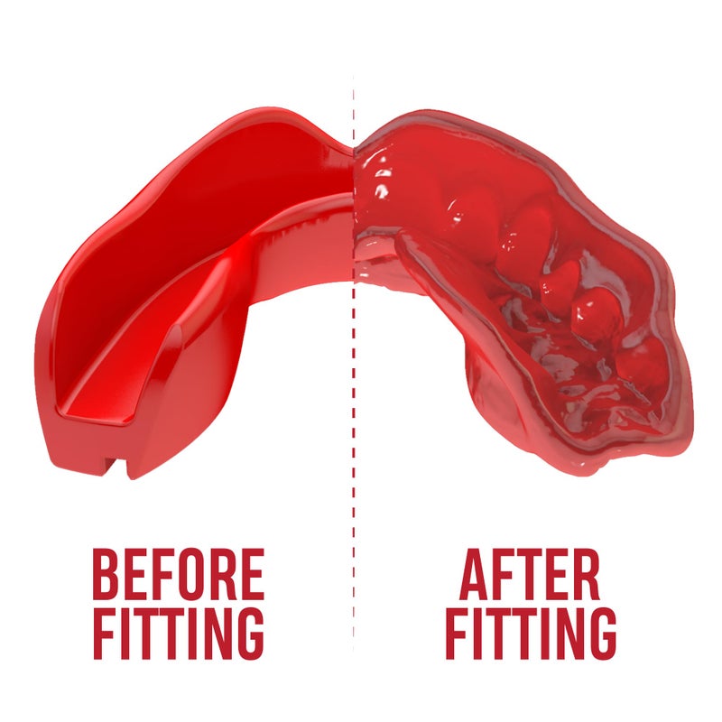 Safejawz Mouthguard Slim Fit  Adults And Junior Mouth Guard With Case For Boxing  Basketball  Lacrosse  Football  Mma  Martial Arts  Hockey And All Contact Sports (Red) - Image 4