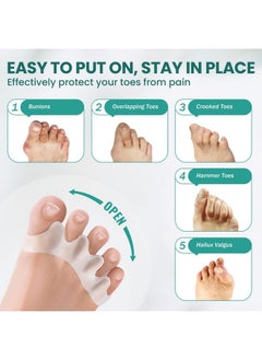 Welnove Toe Spacer Bunion Corrector - 8 Pcs Tea Tree Oil Infused Gel Toe Separator To Restore Hammertoes,Bunion Pads For Women Men, Fits For Yoga Practice  - Image 2
