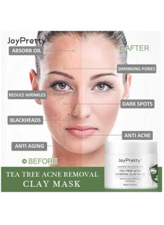 JoyPretty Tea Tree Acne Removal Clay Mask 60g Blackheads & Acne Removal Tea Tree Clay Face Mask Minimize Pores Reduce Blackhead & Acne Anti-Aging Wrinkle Reduction Skincare with Tea Tree Face Mask  - Image 2