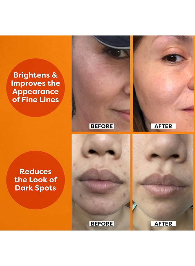 تروسكن مصل فيتامين سي للوجه من تروسكين، مصل مضاد للشيخوخة مع حمض الهيالورونيك وفيتامين إي والصبار العضوي وزيت الجوجوبا، مصل مرطب ومشرق لمحاربة مظهر البقع الداكنة والخطوط الدقيقة والتجاعيد، 1 أونصة سائلة - Image 4