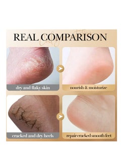 SADOER Collagen Foot Cream, Suitable For Dry & Cracked Feet, Nourishing, Moisturizing, Smoothing & Whitening Foot Skin Care 60g  - Image 4