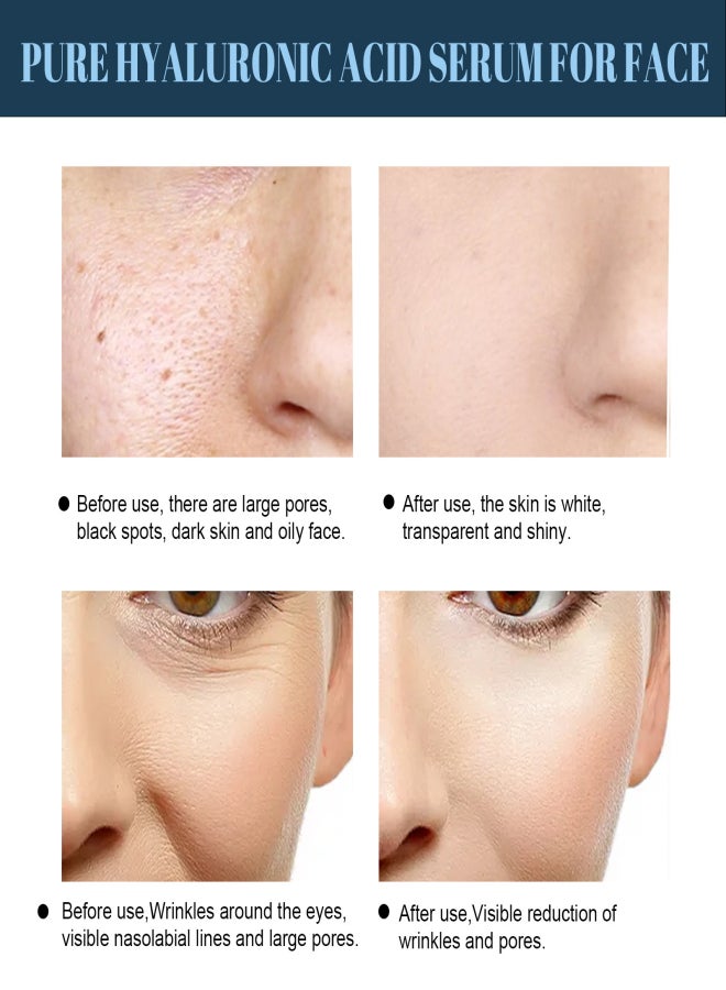 EELHOE Protein Lift Line Skin Anti-Wrinkle V-Face Firming Lifting Sagging Facial Contour - Image 2