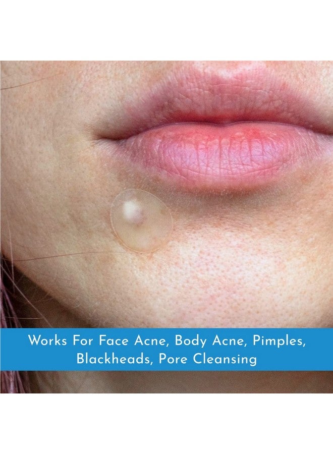 Truly Clear Ruly Clear® Acne Pimple Patches For Face & Body Plant Based Hydrocolloid Blemish Zit Patches Ideal For Cystic Acne Cruelty Free Acne Dots Overnight Results 72 Count  - Image 3