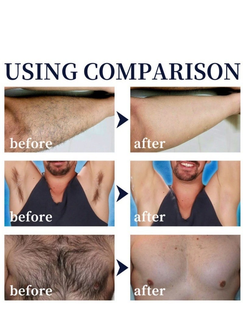 East Moon - Hair Removal Spray Foam for Men, Painless Hair Removal Spray Armpit Gentle Hair Remover Refreshing Quick Hair Removal Spray, Safe Hair Depilatory For Male Underarm, Chest, Back, Legs - Image 1