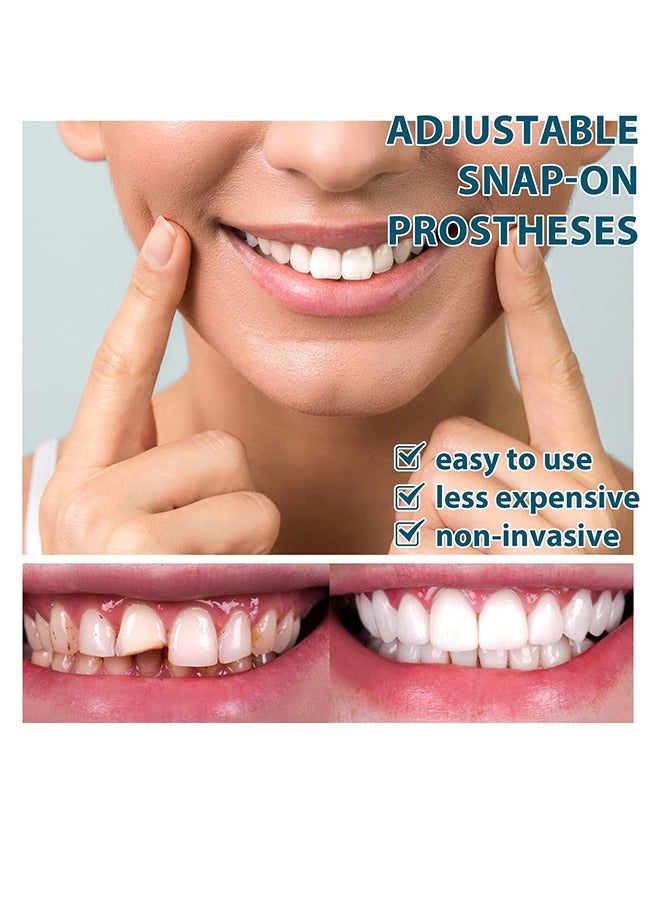 EELHOE EELHOE Adjustable Snap-On Dentures, Upper and Lower Jaw Cosmetic Denture Veneers, Smile Dentures, Temporary Dental Restoration Kit, Instant Snap-On Confident Smile  - Image 4