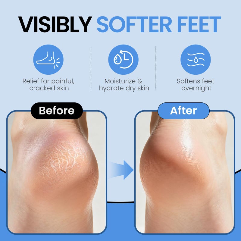 ALUROICE Silicone Moisturizing Socks for Women Men Large- 2Pairs Foot Moisturizer Socks for Dry Cracked Feet- Black Aloe Spa Moisture Hydrating Foot Care Socks (L Up to Size 12) - Image 3