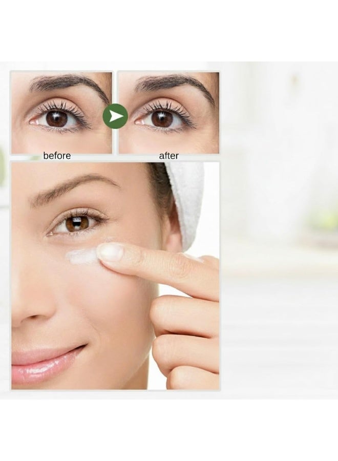 NALACAL Tea Tree Eye Cream, Dark Circle Remover, Anti-Aging Eye Cream for Puffiness, Fine Lines, and Crow’s Feet, Hydrating Eye Serum for Under-Eye Bags and Wrinkles, Skincare for All Skin Types - Image 3