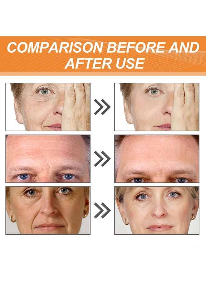 EELHOE - Forehead Wrinkle Patch 10Pcs - Smooths Fine Lines & Wrinkles, Anti-Wrinkle Patches, Contains Hydrolyzed Collagen, Vitamin E, Anti-Wrinkle Patches, Forehead Wrinkle Treatment - Image 1