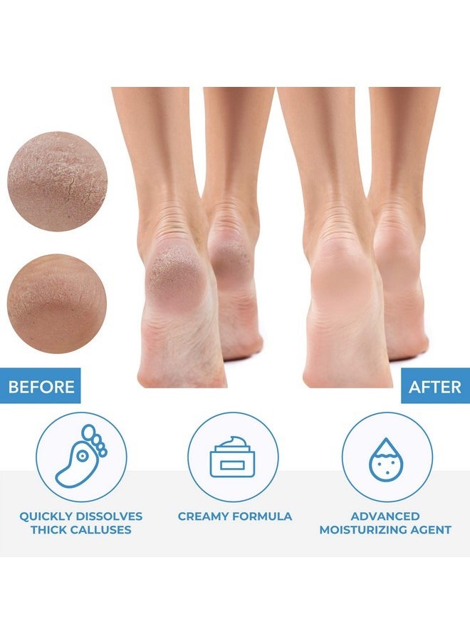 ForPro Professional Collection Premium Callus No More! Callus Remover, Fast-Acting Callus Removing Formula, 32 Oz.  - Image 5