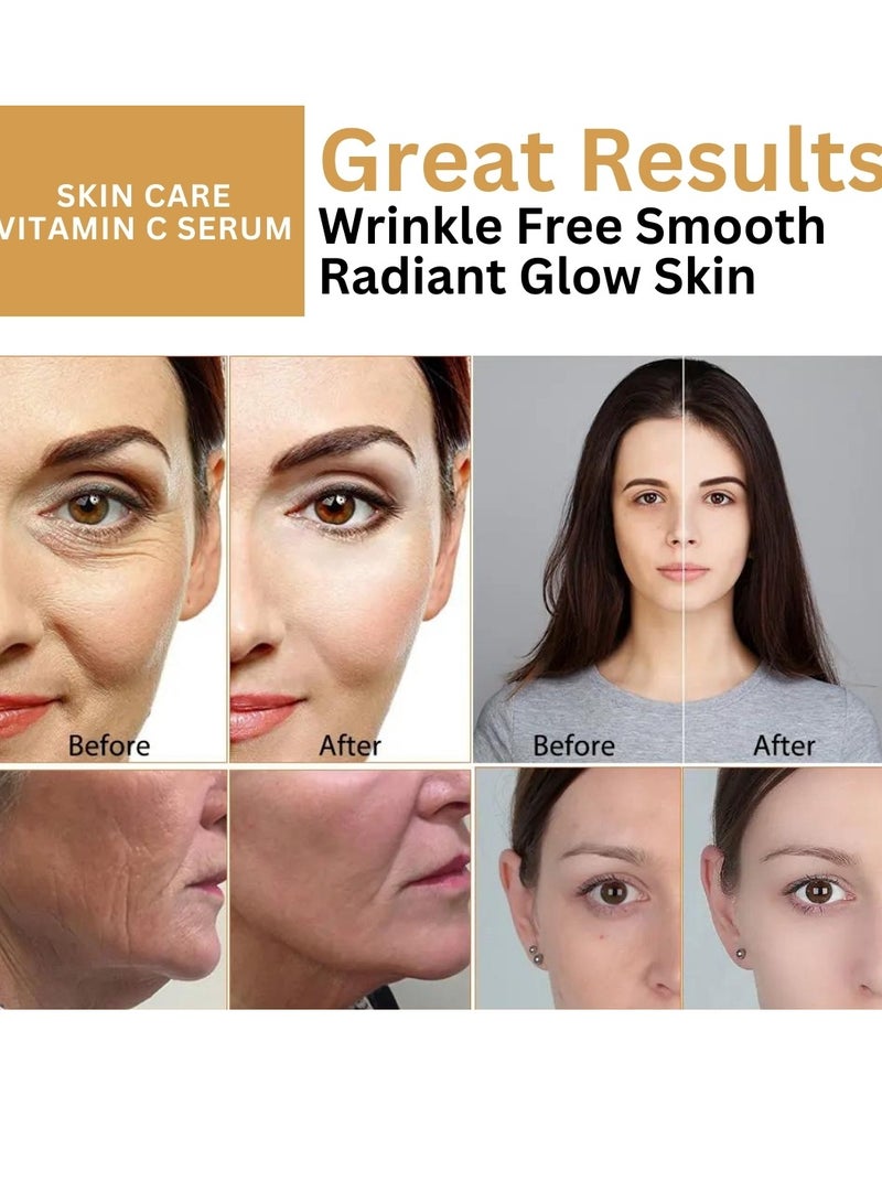 COAZON Vitamin C Serum for Face with Vitamin E and Hyaluronic Acid Boost Skin Collagen Hydrate and Plump Skin Anti Aging and Wrinkle Facial Serum Brightening Skin Corrector 30ml - Image 3