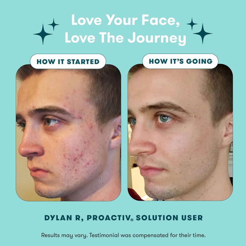 Proactiv علاج حب الشباب 3 خطوات من بروأكتيف - غسول وجه بمادة بنزويل بيروكسايد، علاج موضعي لإصلاح حب الشباب للوجه والجسم، تونر مقشر - مجموعة العناية بالبشرة لحب الشباب لمدة 30 يومًا - Image 5