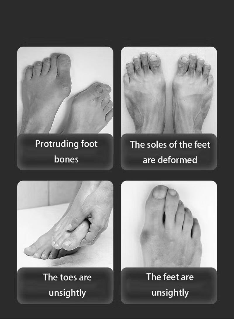 2Pcs Bunion Corrector, Adjustable Knob Bunion Splint For Bunion Relief, Suitable For Left And Right Foot Toe Correction - Image 2