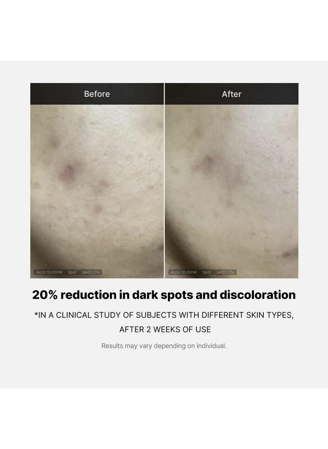 Medicube - Deep Vita C Serum 2.0 14.5% Pure Vitamin C Reduce The Appearance Of Hyperpigmentation Dark Spots And Blemishes 16 Selftests Complete Korean Skincare (10G * 3 Bottles) - Image 1