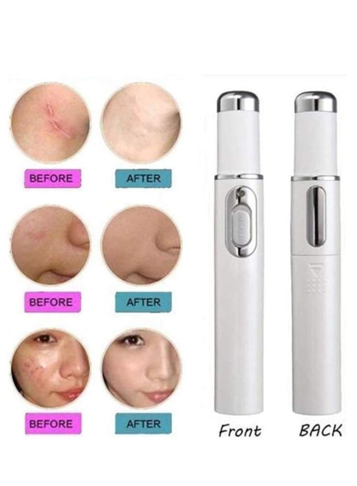 Verci Spider Vein Eraser Pen Blue Light Therapy Machine for Mole Acne Scar Removal, Skin Tightening  - Image 5