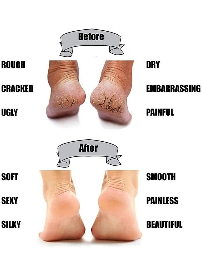 V3E جوارب وسادة كعب من هلام السيليكون V3E لجميع أنواع تورم الكعب وتخفيف الألم، كريم إصلاح الكعب الجاف والمتشقق للعناية بالقدم ودعم الكاحل - للرجال والنساء (كعب كامل) - Image 3